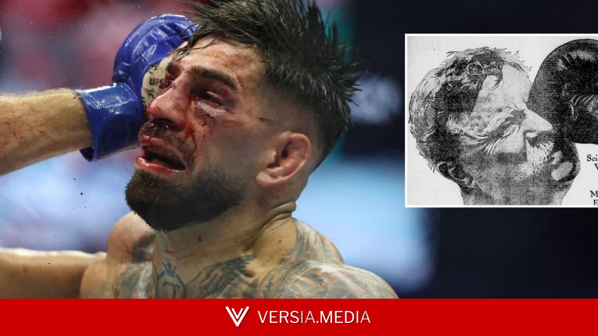 Trump, Topuria y un baño de sangre: los combates de Lincoln y el boxeador Teddy Roosevelt — Health | Versia.media