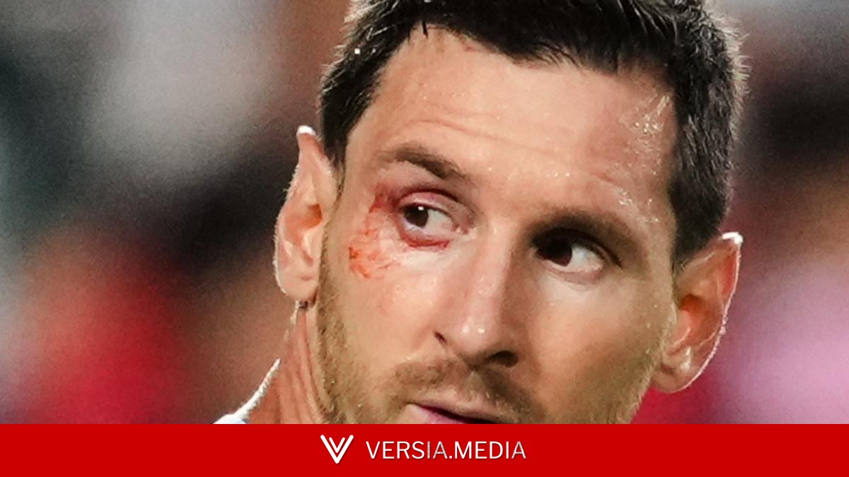 Leo Messi: el día de la cabra