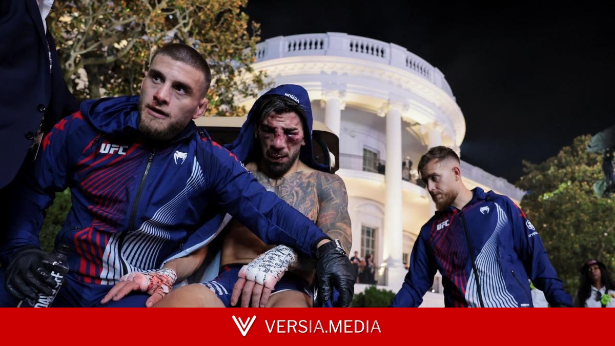 Topuria se va de la Casa Blanca apalizado por Gaethje, desfigurado y sin título de la UFC — Health | Versia.media